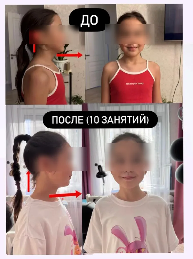Logo_aba, результат занятий: осанка и положение головы до и после