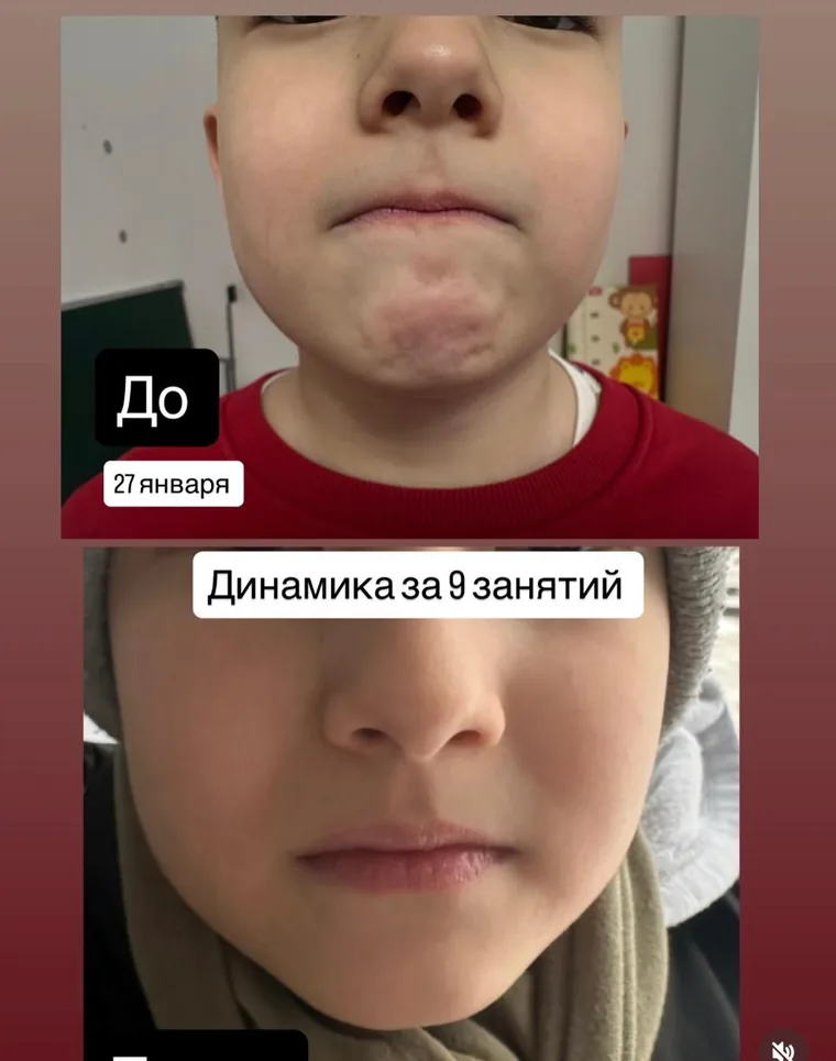 Logo_aba, результат занятий: тонус мышц лица до и после